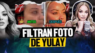 SALE A LA LUZ FOTO DE YULAY PIÑA COMO ERA ANTES DE OPERARSE