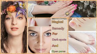 MAGICAL REMEDY FOR DARK SPOTS AND OPEN PORES