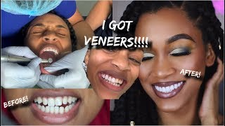 I WENT TO DR \u0026 GOT VENEERS!! |VLOG|