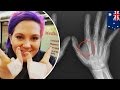 Chip My Life: Australians implanting microchips in their hands to unlock doors - TomoNews