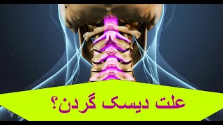 علت بیماری دژنراتیو دیسک گردن چیست؟