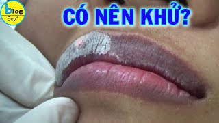 Khử thâm môi là gì? có an toàn không?