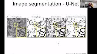 I2K 2020 tutorial: Deep learning assisted image analysis using ZeroCostDL4Mic