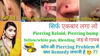 Piercing Bumps, Keloid, Yellow/White pus, Bleeding का आसान इलाज करे l हर Problem की अलग Remedy जाने