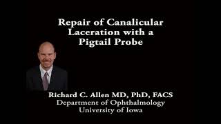 Repair of canalicular laceration with a pigtail probe