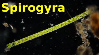 Spirogyra - Under the Microscope