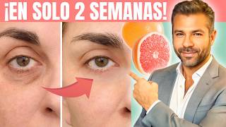 Elimina Tus Ojeras En 2 SEMANAS | Quita Las Bolsas Y Reduce La Inflamación Naturalmente