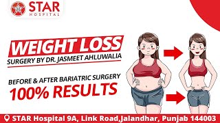 Liposuction for weight loss before and after, Weight Loss Surgery By Dr. Jameet ahluwalia, Jalandhar