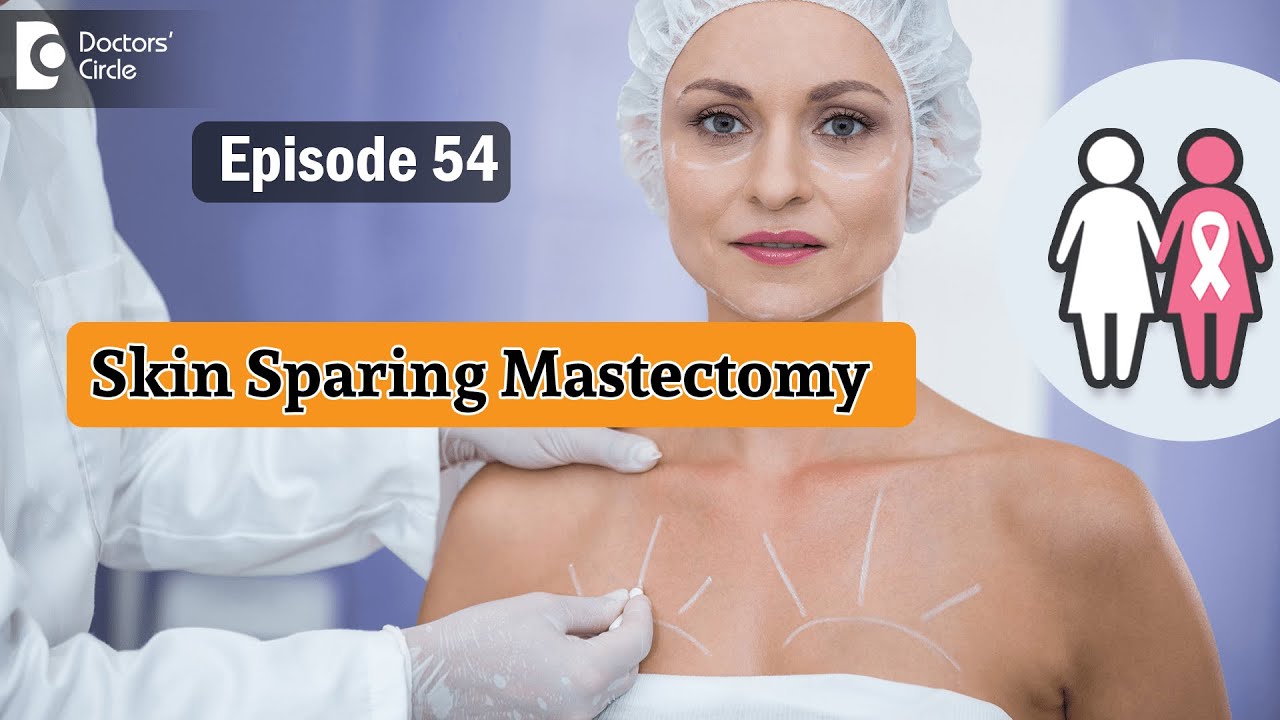 SKIN SPARING MASTECTOMY In Breast Cancer Treatment - Dr.Sandeep Nayak ...