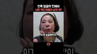 반쪽 얼굴 민혜씨의 너무 커진 마음의 상처 1편