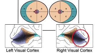 RS Visual Fields Part 4  - Dealing With The Constricted Field