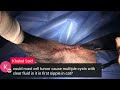 live stream mast cell tumour caudal thigh dog