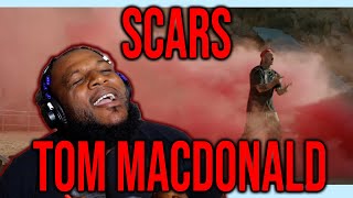 TWIGGA HAS SCARS EVERYWHERE FROM LIFE - Tom MacDonald - \