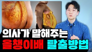 팔 다리는 가는데 왜 유독 배만 튀어 나올까? 지방을 빼는 효과적인 방법