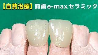 【歯科技工】自費治療でできる白い歯オールセラミック前歯2本の「emaxセラミック冠」歯科技工士作業動画（exocad3.1ソフト）