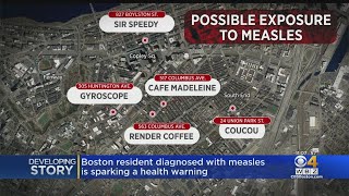 Boston Resident Diagnosed With Measles