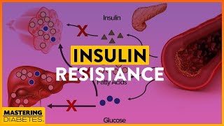 What is Insulin Resistance and What Causes Insulin Resistance | Mastering Diabetes | Cyrus Khambatta
