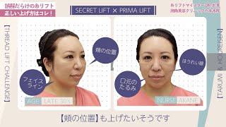 【体験動画】スタッフが糸リフトを受けてみた！【若返り】