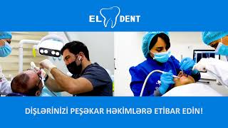 EL DENT - stomatoloji klinika / dişlərin düzgün müalicəsi / peşəkar həkimlər / #implantdiş / zəmanət