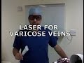 Laser for Varicose Veins Explanation and Demonstration (EVL EVLT)