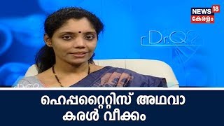 Dr Q : ഹെപ്പറ്റൈറ്റിസ് അഥവാ കരള്‍ വീക്കം | Hepatitis | 30th July 2018