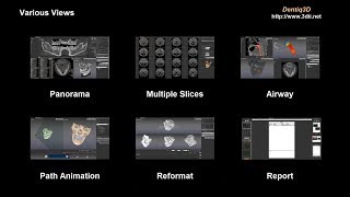 Dentiq3D - Views