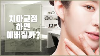 치아교정하면 생기는 외모의 변화