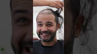 Shaving Off The Combover