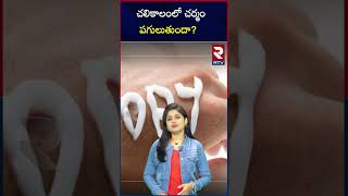 చలికాలంలో చర్మం పగులుతుందా?  |  winter skin problems | solutions | RTV