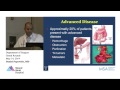 Updates on Colorectal Cancer