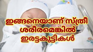 ഇരട്ട കുട്ടികൾ ജനിക്കാനുള്ള 5 കാരണങ്ങൾ