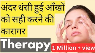 आँखों के अन्दर धसने की Best Therapy । How to get rid of sunken eye | #eyecaretaker #humaneye