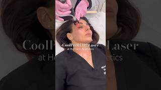 CoolPeel CO2 Laser at Hermann Aesthetics