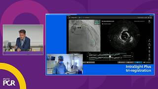 Contemporary workflow for class IA PCI - EuroPCR 2026