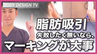 脂肪吸引、失敗しないために！マーキングの大切さについて解説します｜vol.221【ボディデザインTV】