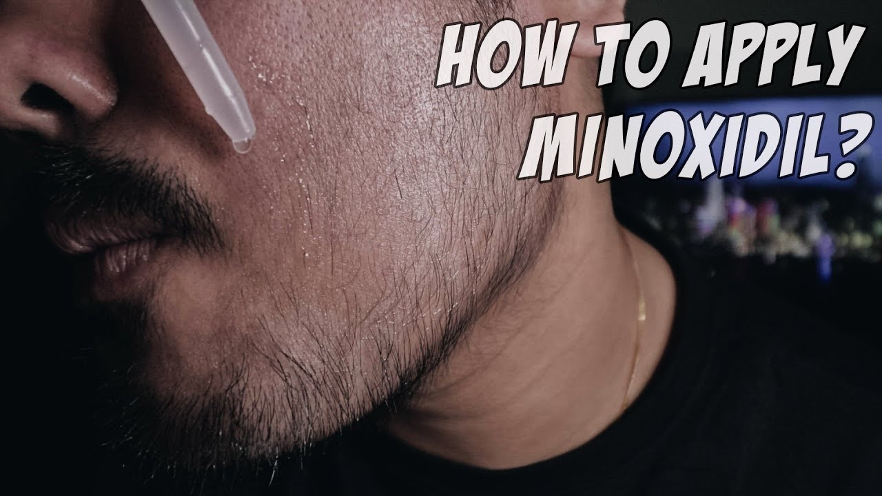 Minoxidil For Beard Growth Week 12: How To Apply Minoxidil? - YouTube