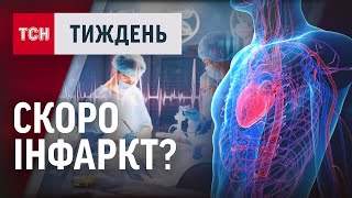 ЯК РОЗПІЗНАТИ ІНФАРКТ?