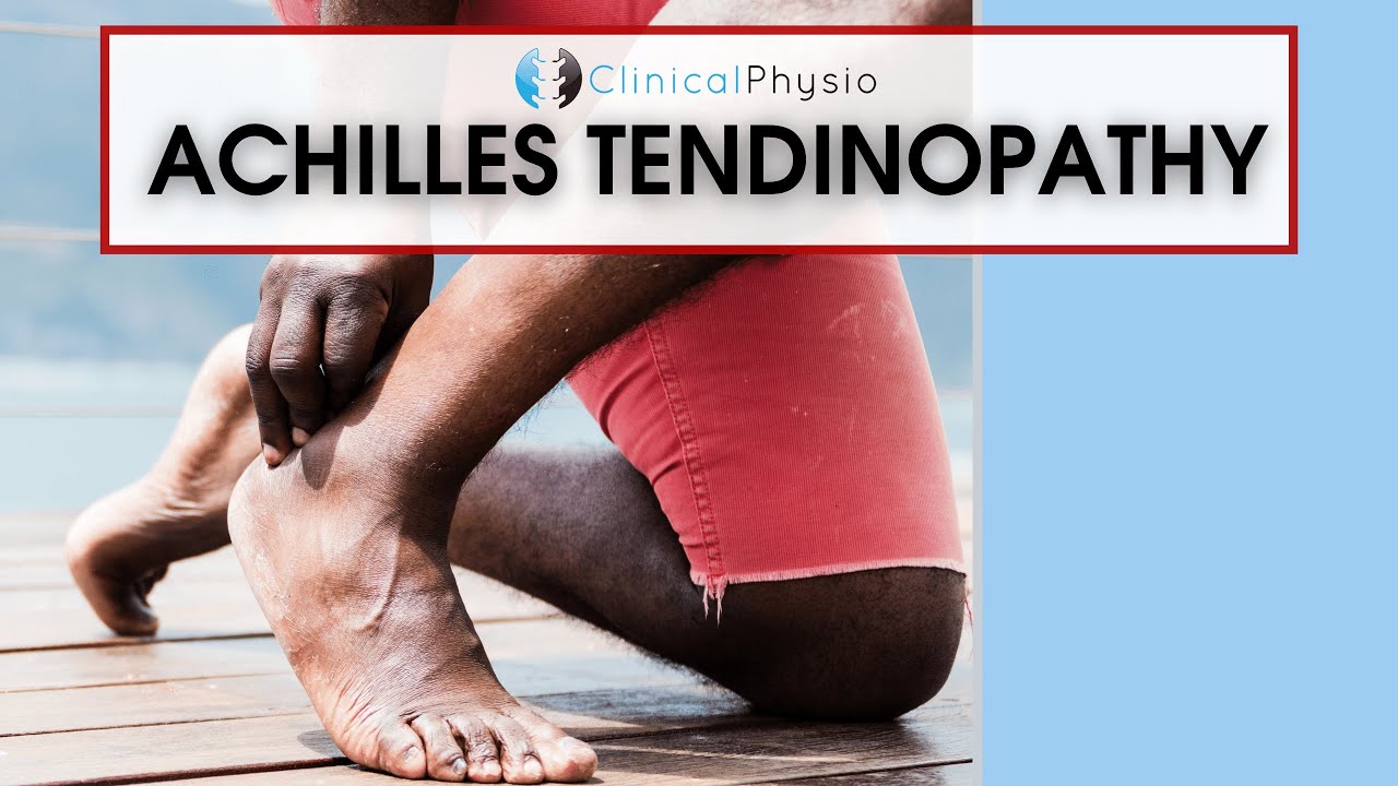 Achilles Tendinopathy | Best Physio Assessment And Treatment Tips ...