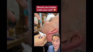 Should Your Barber Treat Your Cyst?