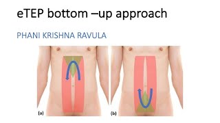 AWR series : eTEP RS bottom up approach Phani Krishna Ravula