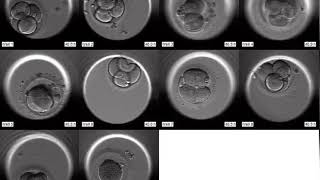 Placa de Embryoscope