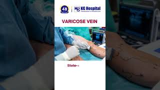 Pain Less Treatment for Varicose vein