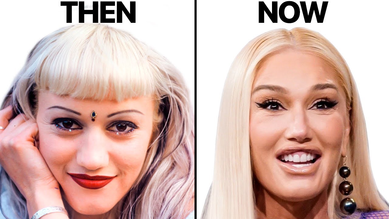 Gwen Stefani New Face Plastic Surgery Analysis Cyber Clinic