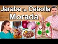 Jarabe De Cebolla Morada ¿Para Qué Sirve? - Beneficios Para Tu Salud Y Belleza