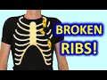6 Do’s & 6 Don’ts To Recover From Broken Ribs