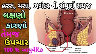 ભગંદર ની સંપુર્ણ જાણકારી અને ઈલાજ | Fistula Complete Treatment | Bhagandar Bavasir Pails