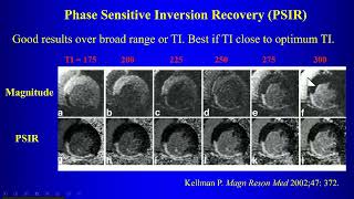 5c Cardiac MRI P3