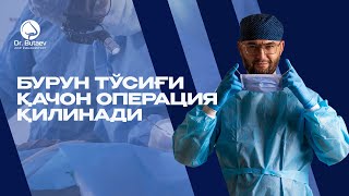 Бурун тўсиғи қачон операция қилинади | Доктор Бутаев