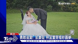 勇敢追愛! 「肌萎症」林宜萱穿婚紗圓夢｜TVBS新聞 @TVBSNEWS02