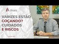 Varizes Estão Coçando? Cuidados e Riscos